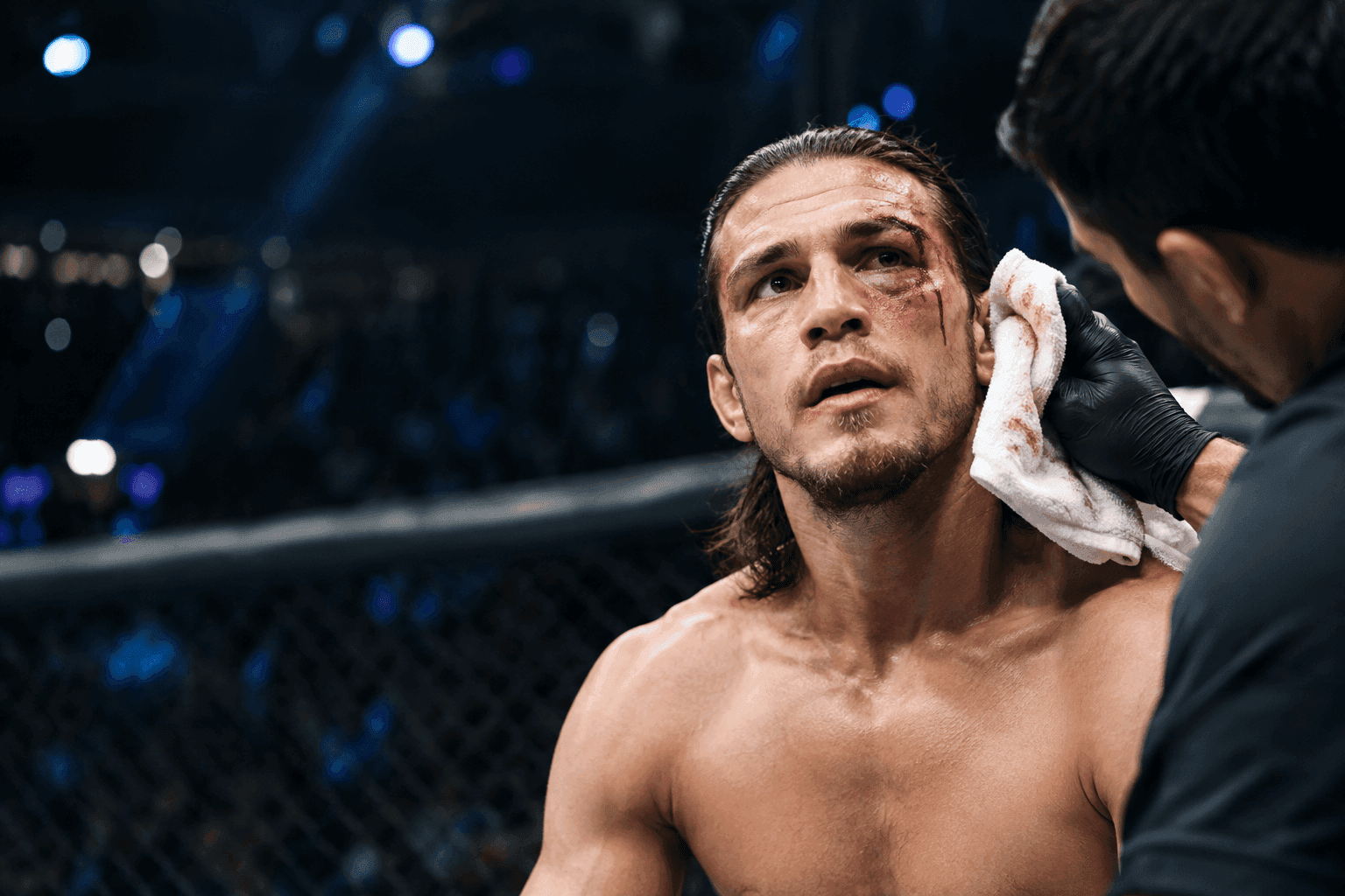 Editorial sports image for Brian Ortega Out of UFC 331 After Freak Training Headbutt